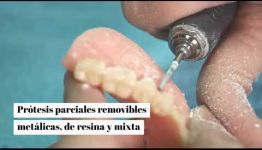 FORMACIÓN DE PRÓTESIS DENTALES: TEMARIO Y LAS SALIDAS PROFESIONALES